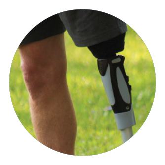 Lightweight hydraulic knee